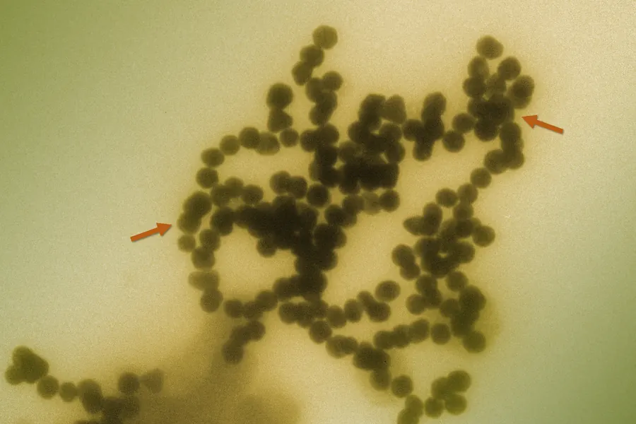 Clustered nanoparticles seen through a transmission electron microscope
