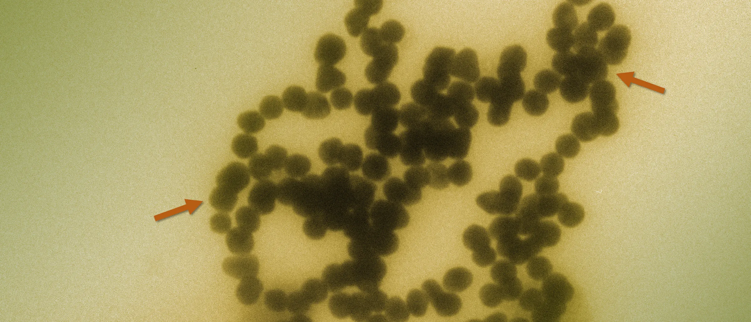 Clustered nanoparticles seen through a transmission electron microscope